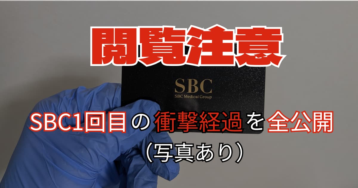 【閲覧注意】剛毛男のVIO脱毛ビフォーアフター｜湘南美容1回目の経過を全公開